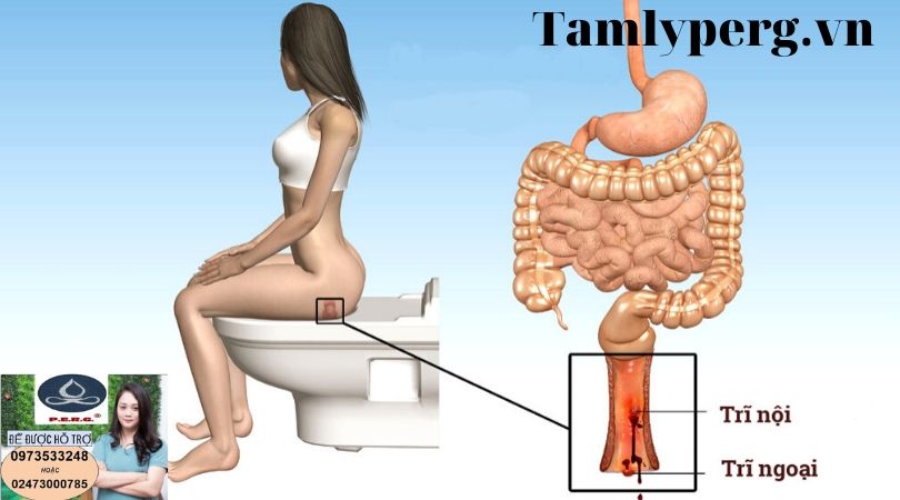 BỊ TRĨ NỘI VÌ GHEN TUÔNG